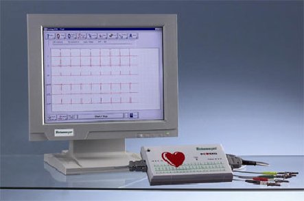 EKG